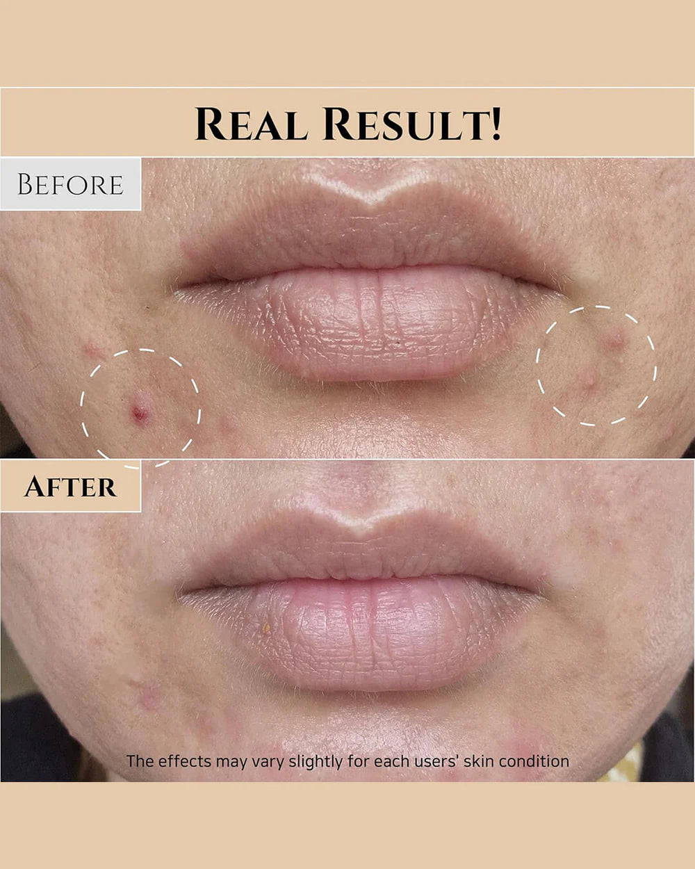 BEAUTY OF JOSEON Glow Replenishing Rice Milk - Nemlendirici Losyon