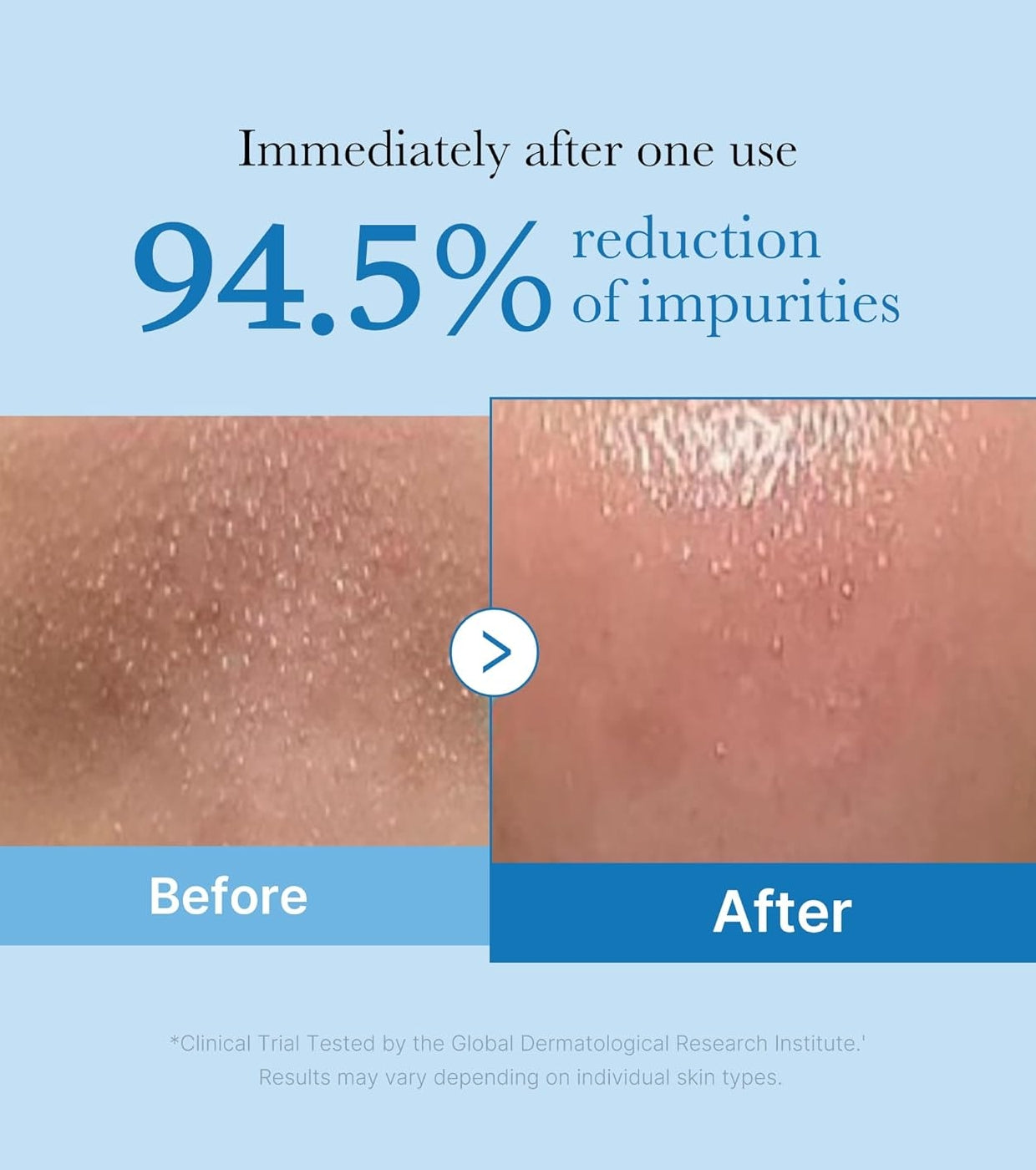 Medicube – Zero Pore Blackhead Deep Cleansing Oil (Gözenek ve Siyah Nokta Karşıtı Derin Temizleyici Yağ)