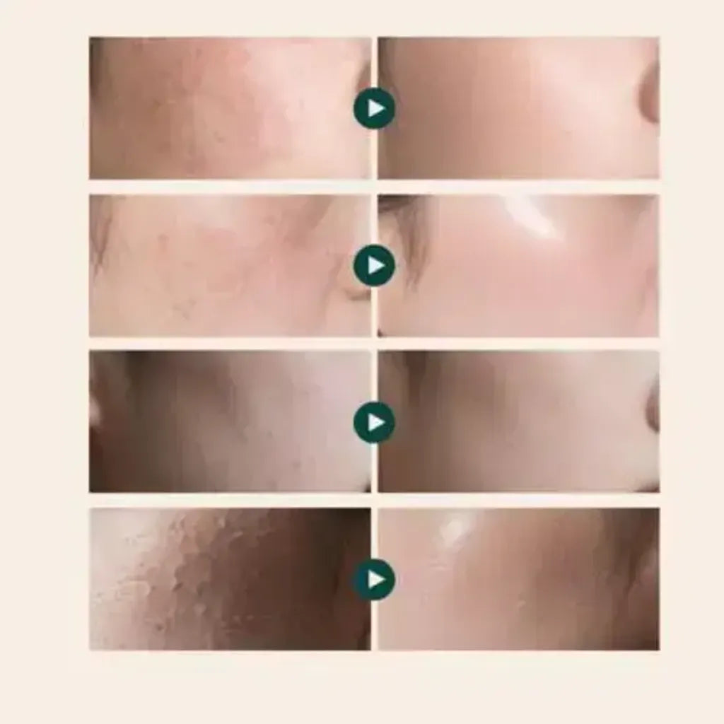 SEORYA ÖNERISI REJUALL – Advanced PDRN Repair Cream (Gece Onarıcı Yenileyici Krem)